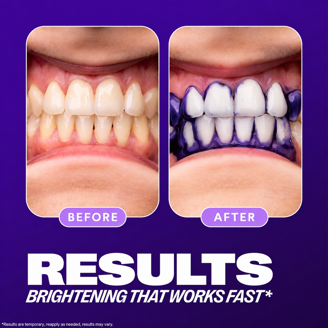💜 The Magic Purple Toothpaste for a Brighter Smile! ✨